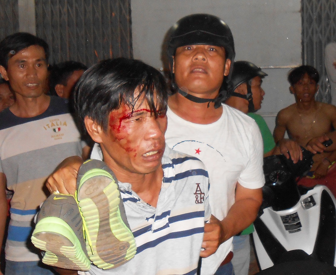 'Hiep si' da vang hung khi tren tay ten trom xe SH hinh anh