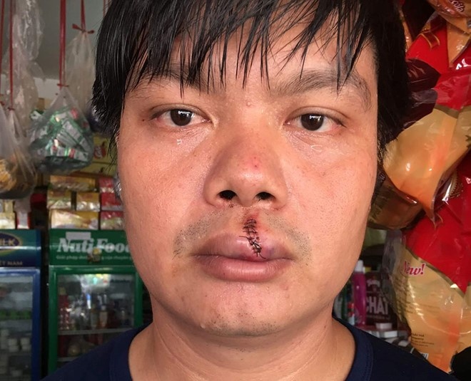 Nguoi dan ong to cao o nhiem moi truong bi vay danh hinh anh