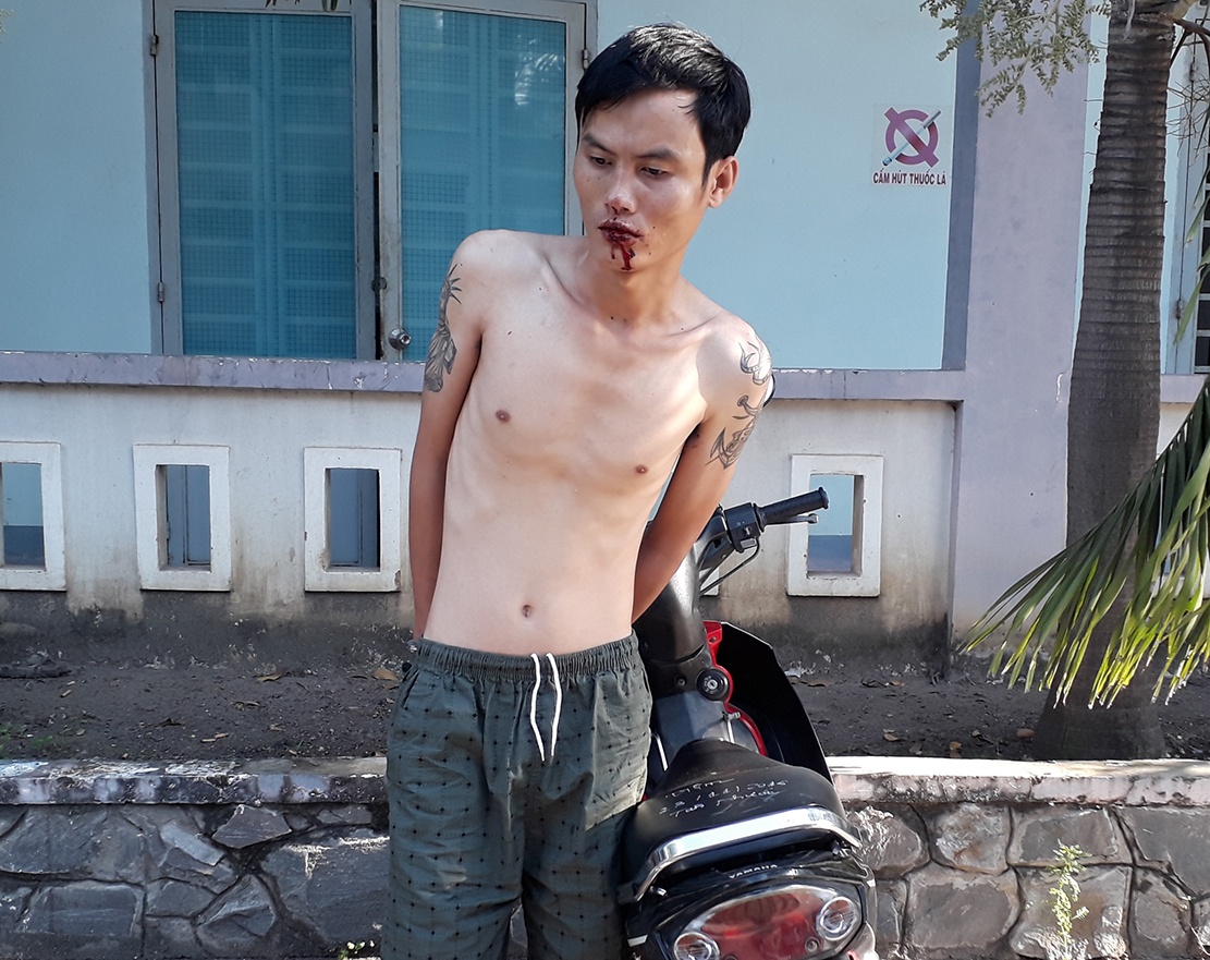 Tên trộm xe máy bị bắt ảnh 1 Ten trom xe may bi bat anh 1