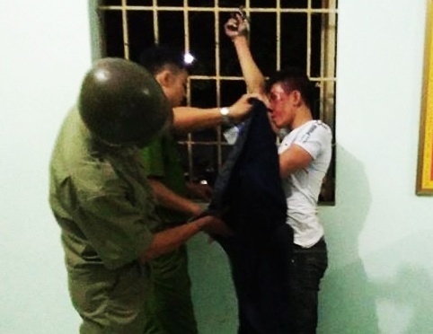 Vay bat ke trom xe may, 2 nguoi dan bi chem hinh anh