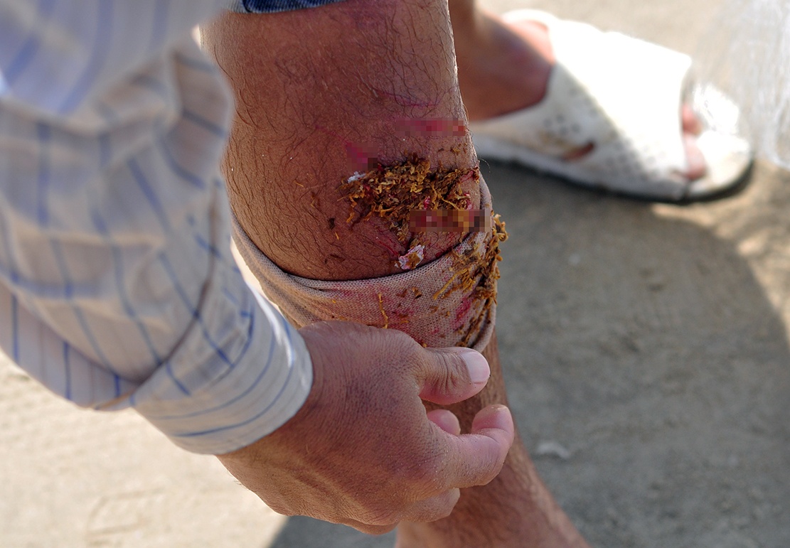 nem da xua ca vao bo anh 9