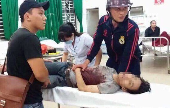 Hai thanh nien guc ben quoc lo voi nhieu vet dam tren co the hinh anh
