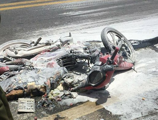 cháu bé bỏng nặng vì cháy xe máy ảnh 1 chau be bong nang vi chay xe may anh 1