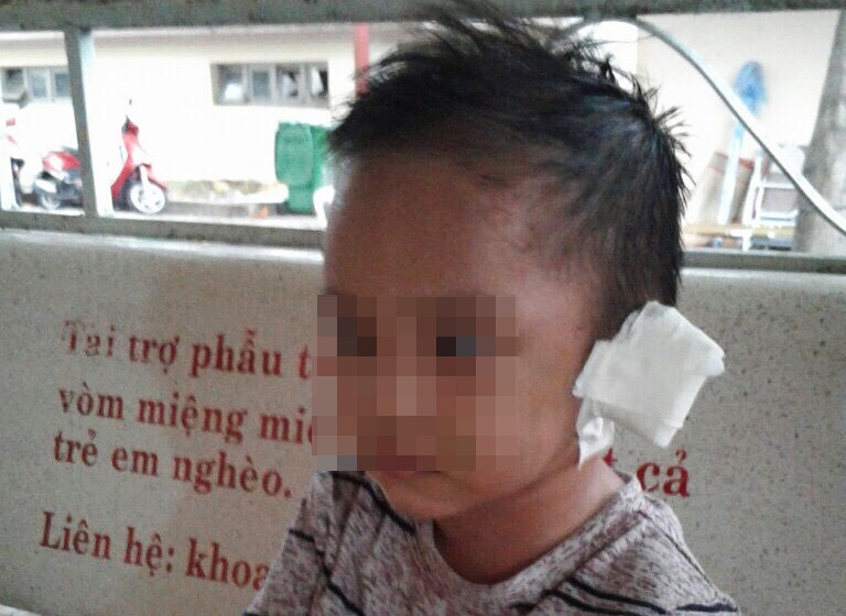 Be 3 tuoi nghi bi me va 'cha duong' bao hanh hinh anh