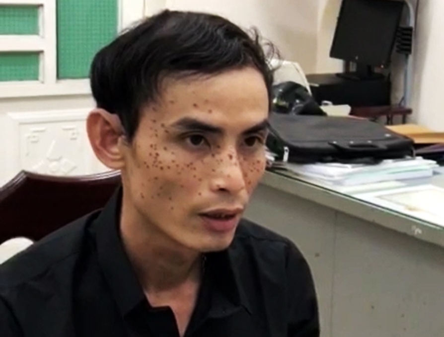 bắt kẻ cầm đầu nhóm cướp ảnh 1 bat ke cam dau nhom cuop anh 1