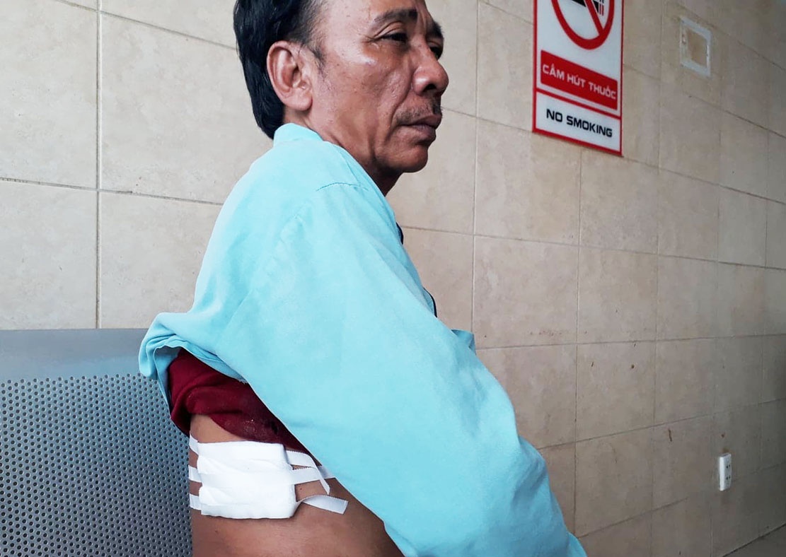 Hiep si bi cuop dam: 'Khong ai dam xong vao, chung binh than di' hinh anh