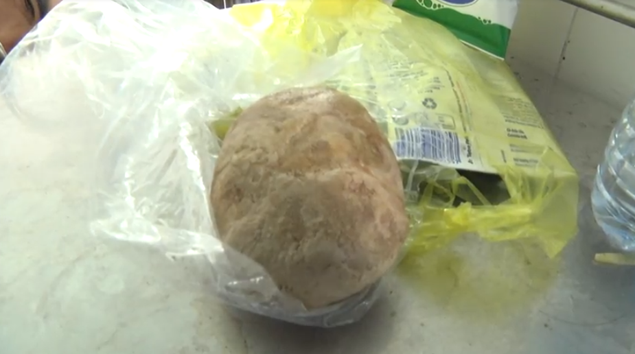 Soi nang nua kg nam trong bang quang nguoi dan ong hinh anh