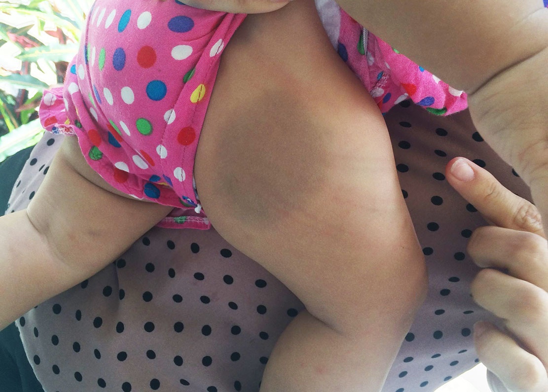 trẻ 8 tháng tuổi bị bạo hành ảnh 2 tre 8 thang tuoi bi bao hanh anh 2