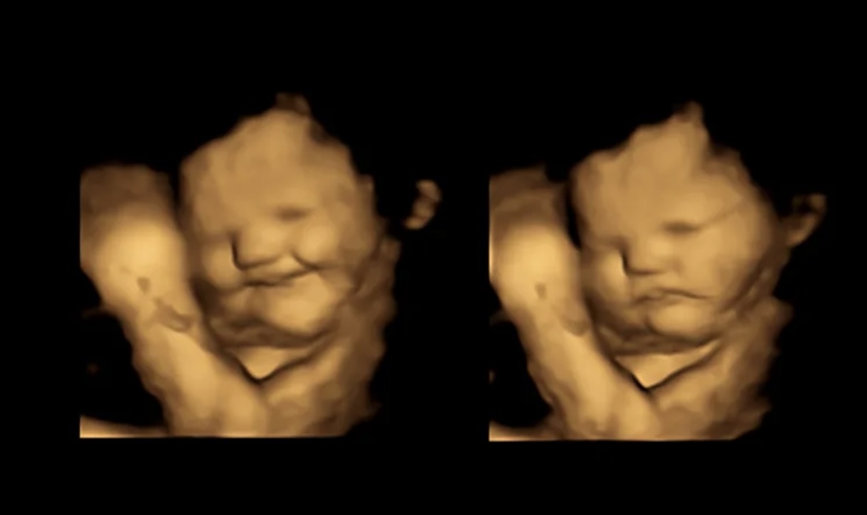 Thai nhi bieu hien cam xuc khac nhau khi me an ca rot va cai xoan hinh anh