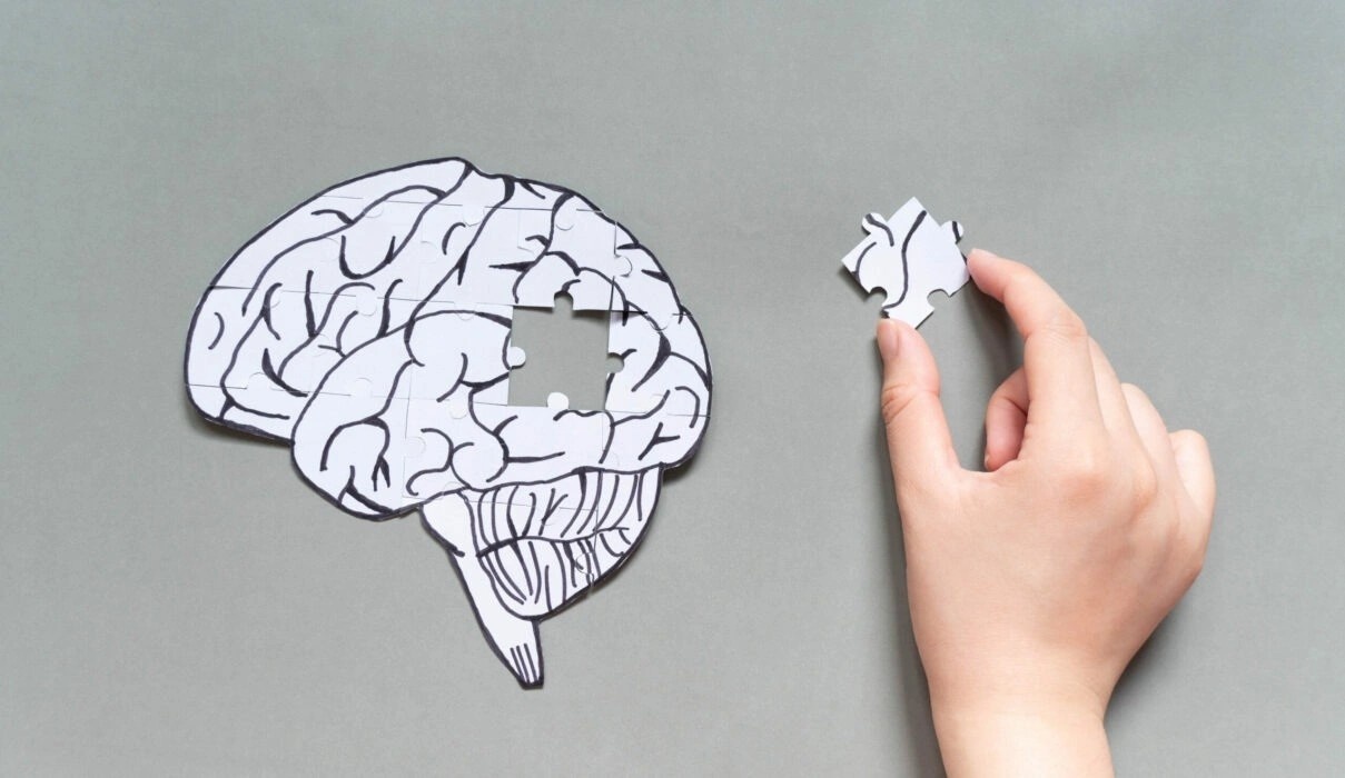 Bai kiem tra 30 phut giup phat hien som chung sa sut tri tue hinh anh