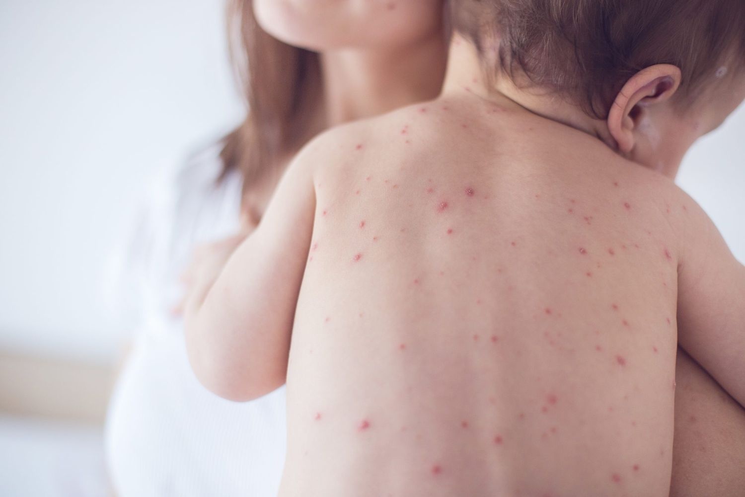 bệnh truyền nhiễm ảnh 1 benh truyen nhiem anh 1