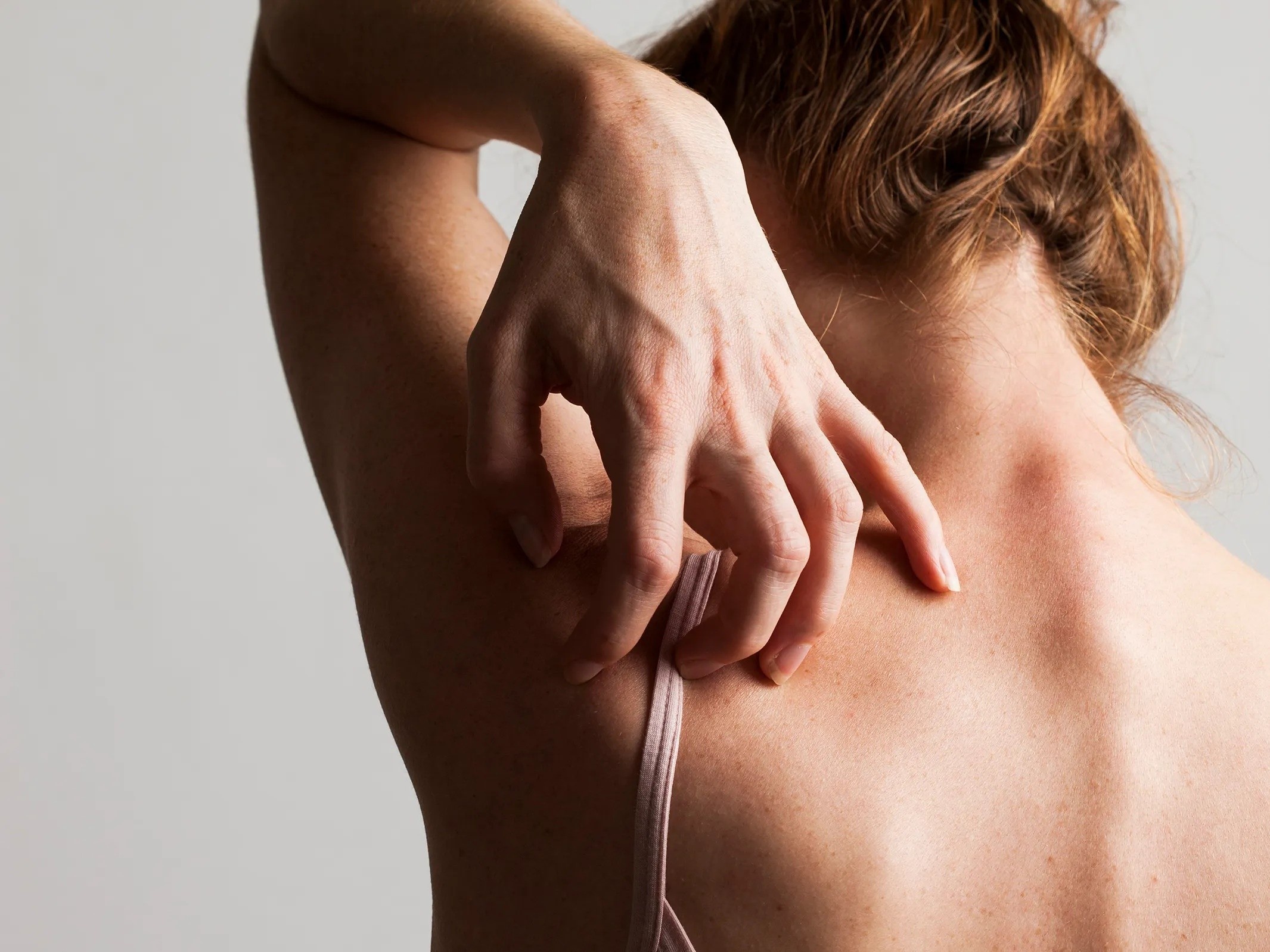 Dung nham lan benh thuy dau va benh soi hinh anh