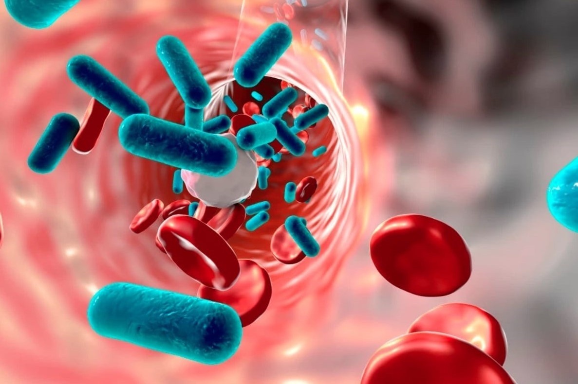 Nhiem khuan la nguyen nhan gay tu vong thu 2 tren the gioi hinh anh