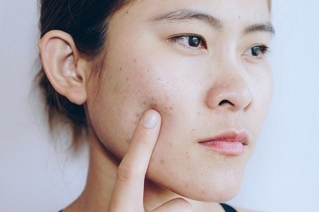 Nhan 'trai dang' khi dung serum dac tri theo tu van tren mang hinh anh