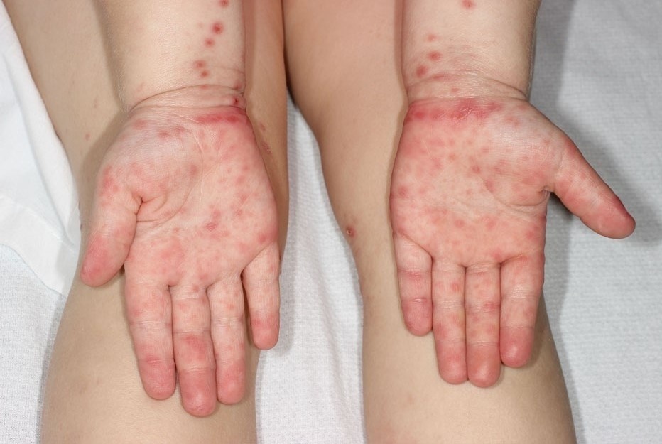 Be trai o TP.HCM dot ngot sung bam khap nguoi hinh anh