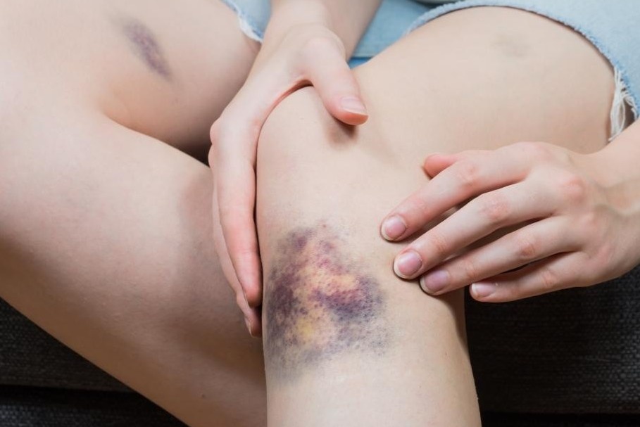 Be trai 7 tuoi mac 'can benh hoang gia' hinh anh