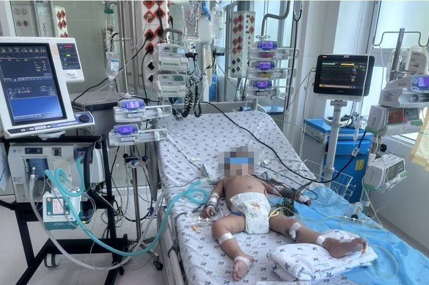 Benh nhi suy ho hap, ton thuong gan nang do soc sot xuat huyet hinh anh