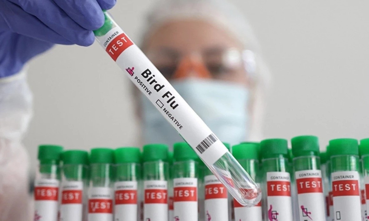 Chile phat hien ca cum gia cam dau tien o nguoi hinh anh