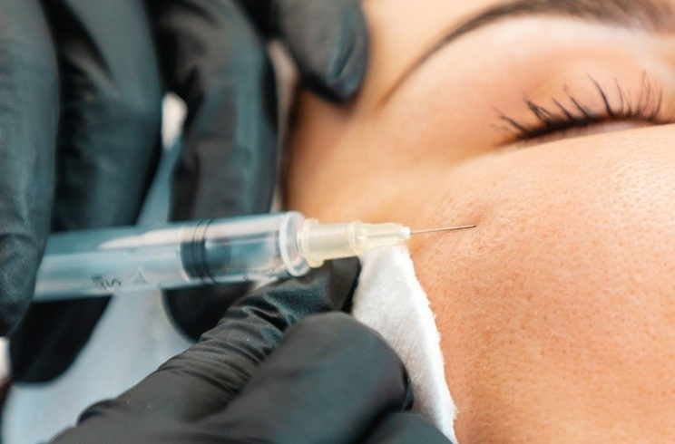 Nguoi phu nu bi tai bien nang sau khi duoc tiem filler mien phi hinh anh