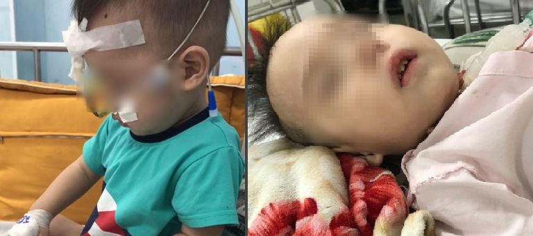 ton thuong nao anh 1