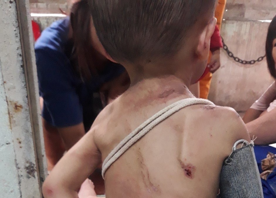 Be trai xuat huyet nao, da chan thuong do bi bao hanh o TP.HCM hinh anh