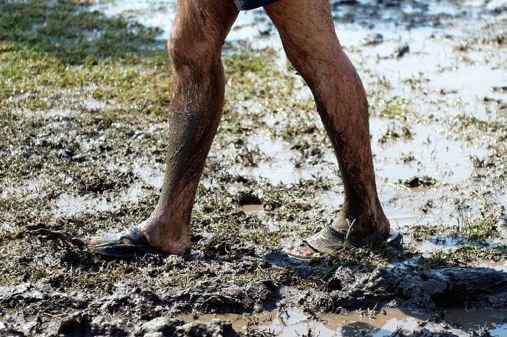 Tinh hinh benh nhan mac Whitmore o Dak Nong hinh anh