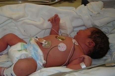 Be trai An Do mac benh hiem gap sau 10 ngay sot lien tuc hinh anh