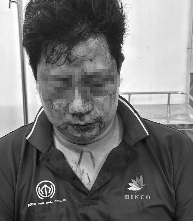 Va cham giao thong. anh 2