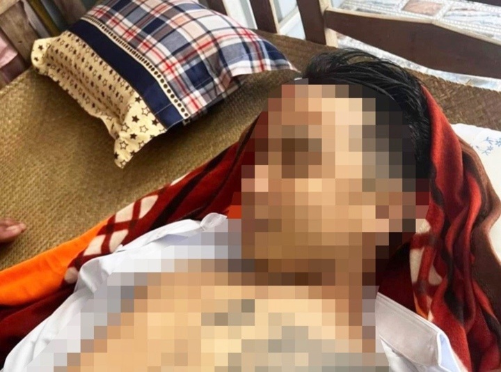 Bat tam giam nhom nguoi sat hai nam thanh nien hinh anh