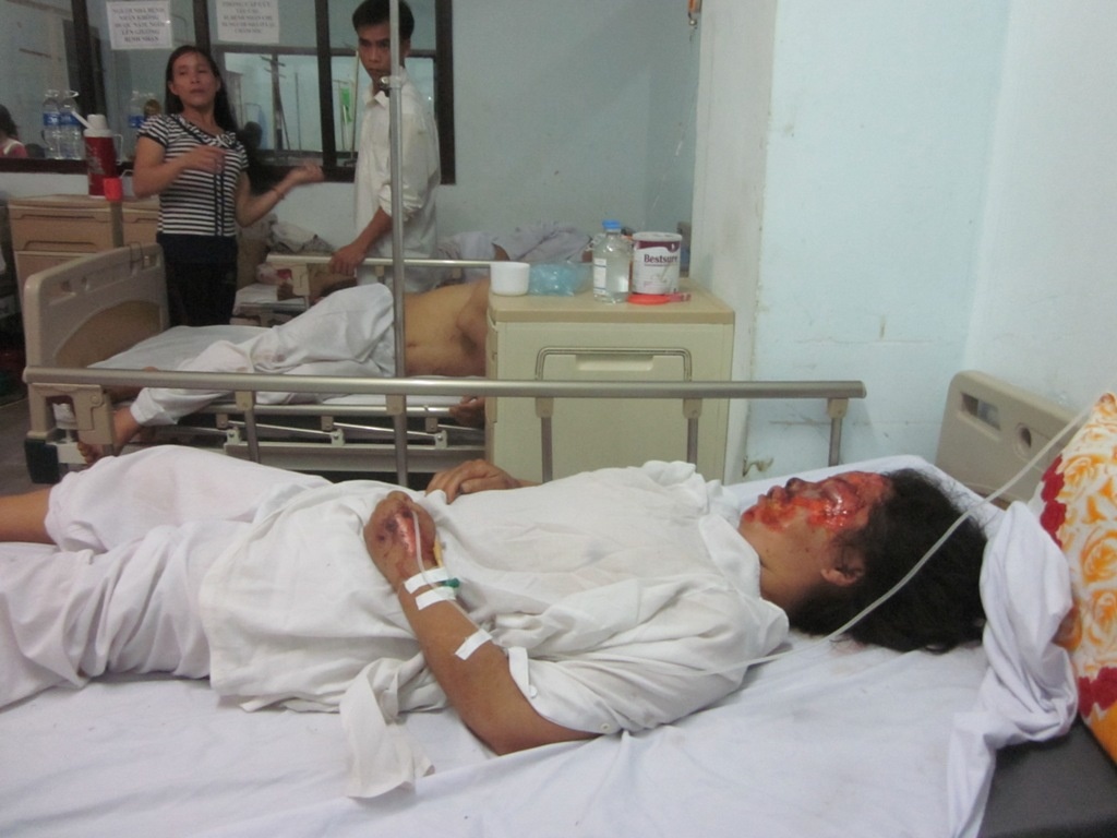 Xe khach o Lao lao xuong vuc, nhieu nguoi nguy kich hinh anh