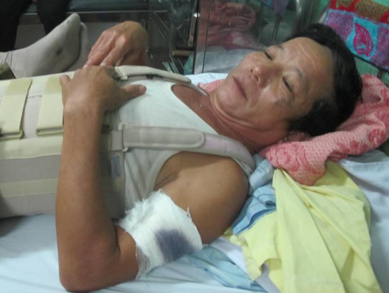 Truy duoi 2 cau tac, chu nha bi chem phai nhap vien hinh anh