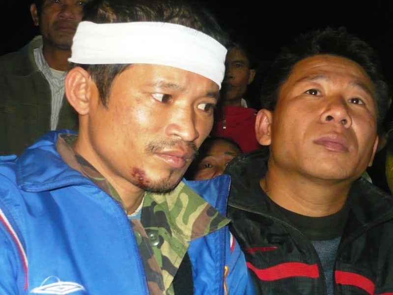 Nguoi song sot ky dieu tro ve trong vong vay cua ba con hinh anh