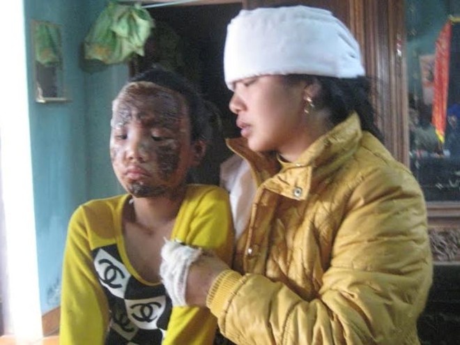 Khoi to vu qua sinh nhat phat no khien ca nha thuong vong hinh anh