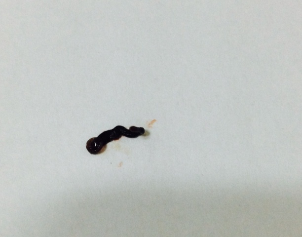 Con vat dai 3cm chui vao mat nguoi song nhieu ngay hinh anh