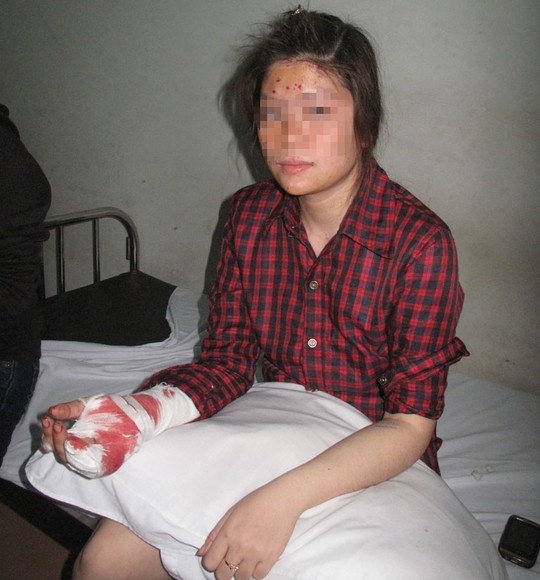 Buu pham gui giam doc phat no, nu ke toan bi thuong hinh anh