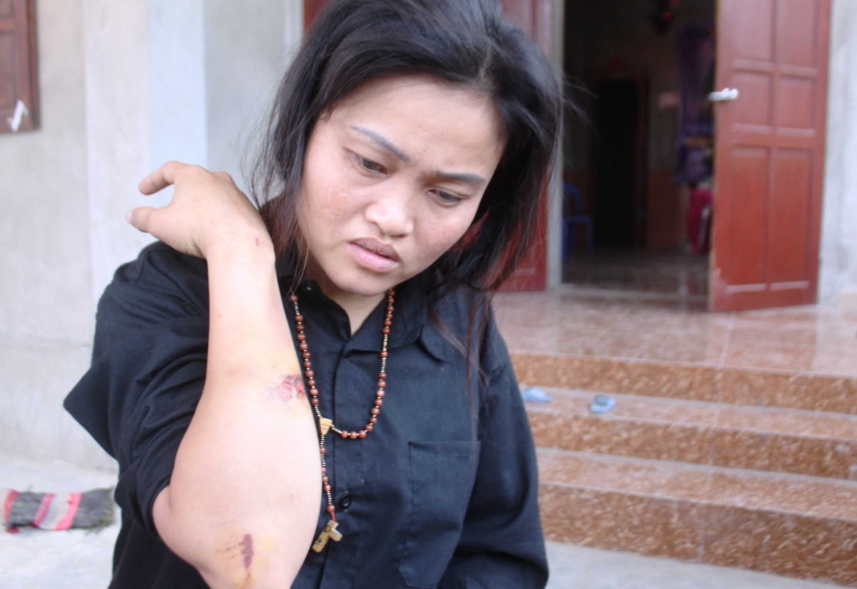 Chị Mai cũng bị thương sau vụ tai nạn xảy ra.