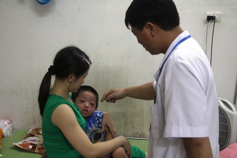 3 tre tu vong, Nghe An khoanh vung benh nhi mac soi hinh anh