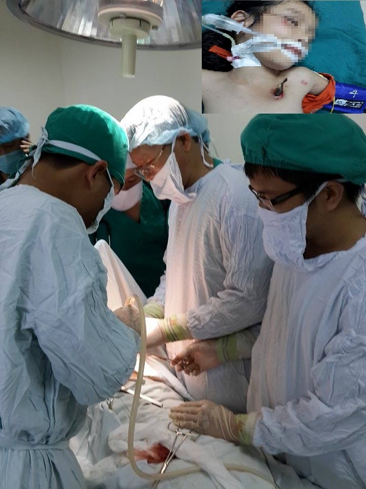 Cháu Nhi bị đâm thủng phổi (ảnh nhỏ) và Êkíp mổ đang tiến hành phẫu thuật cho bé (ảnh lớn)
