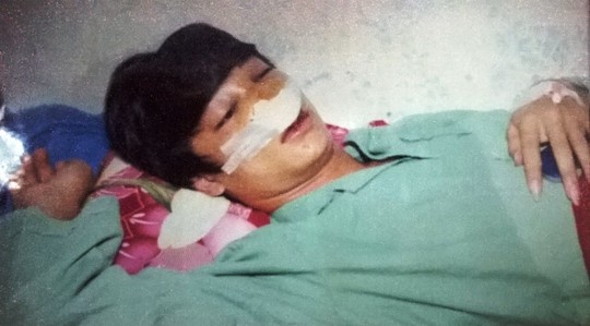 Hoc sinh lop 11 to bi CSGT danh vo xuong mui hinh anh