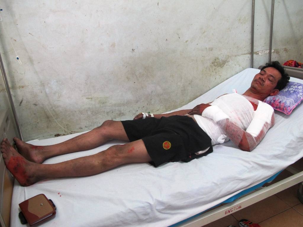 Hai nan nhan vu no lo luyen thep qua doi hinh anh