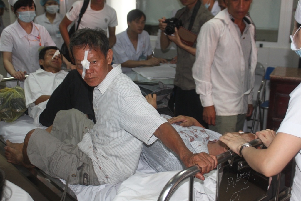 Tại bệnh viện 115 Nghệ An có 20 người nhập viện cấp cứu. Các bệnh nhân hầu hết bị chấn thương ở vùng mặt, đầu gối. Có 5 người bị thương nặng, gãy chân tay đã được nhập viện điều trị.