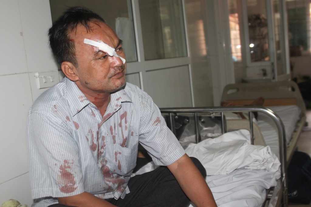 Ông Nguyễn Quang Đồng (59 tuổi, ở xã Phù Đổng, huyện Gia Lâm, Hà Nội) là một trong những người bị thương cho biết, chiếc xe chở 40 người là cán bộ hưu trí và đang làm việc của xã Phù Đổng, huyện Gia Lâm đi tham quan du lịch ở Cửa Lò và thăm quê bác thì gặp tai nạn. 