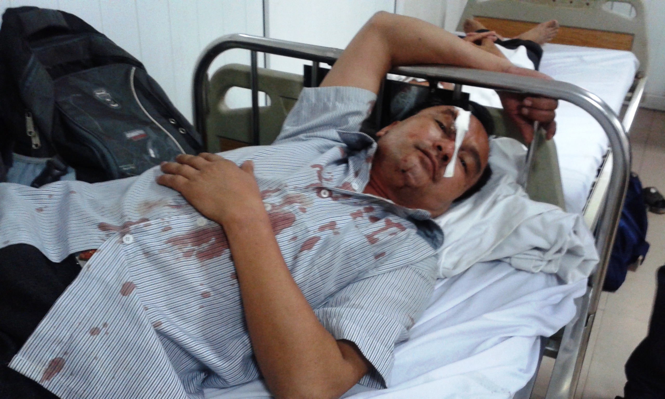 'Toi vua nhac tai xe di cham thi xe gap nan' hinh anh