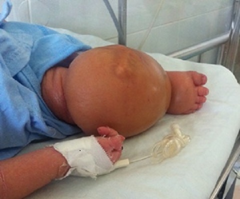 Benh nhan vo cung dac biet hinh anh