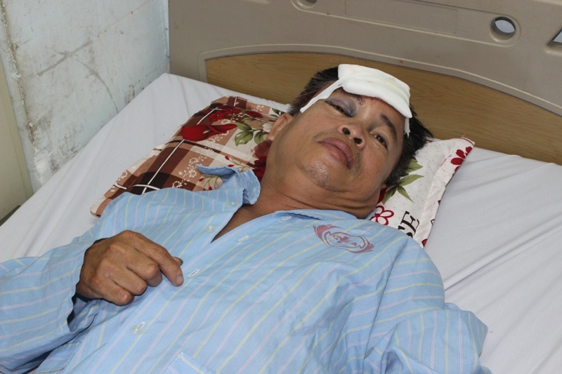 Truy lung nghi pham trom cho chem cong an xa nhap vien hinh anh