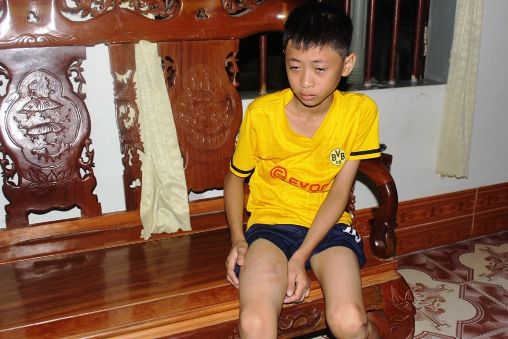 Vu bon nuoc de chet 2 HS: 'Cac ban chau chay mau nhieu lam' hinh anh