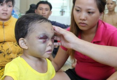 Be gai 4 tuoi bi me va duong danh chan dong nao hinh anh