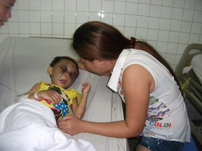 Bé Ngân đang cấp cứu điều trị tại Bệnh viện Đa khoa Bình Dương.