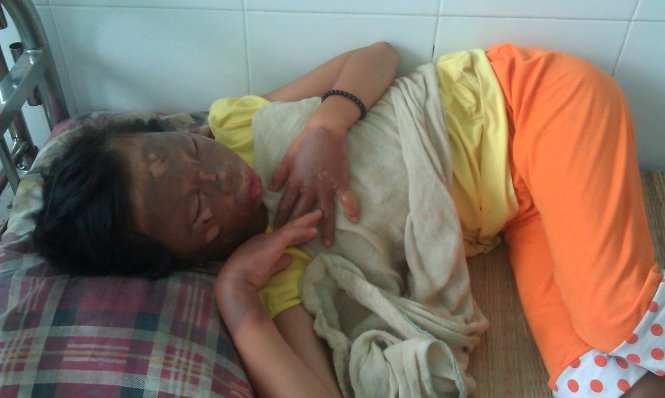 No bep gas mini, ba me con nhap vien hinh anh