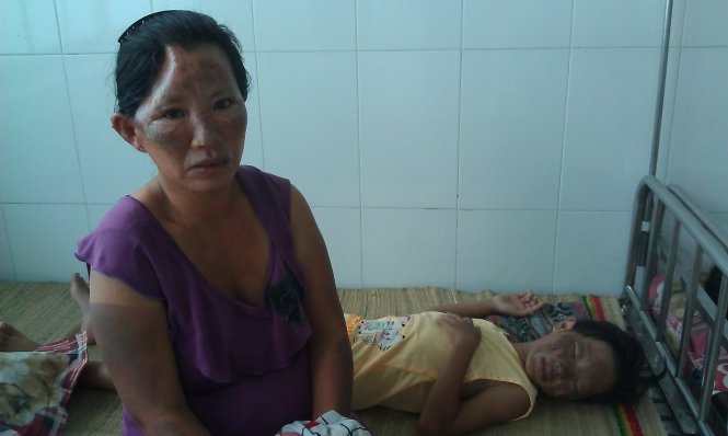 Bà Thuần và cháu Nguyên đang được điều trị tại bệnh viện.